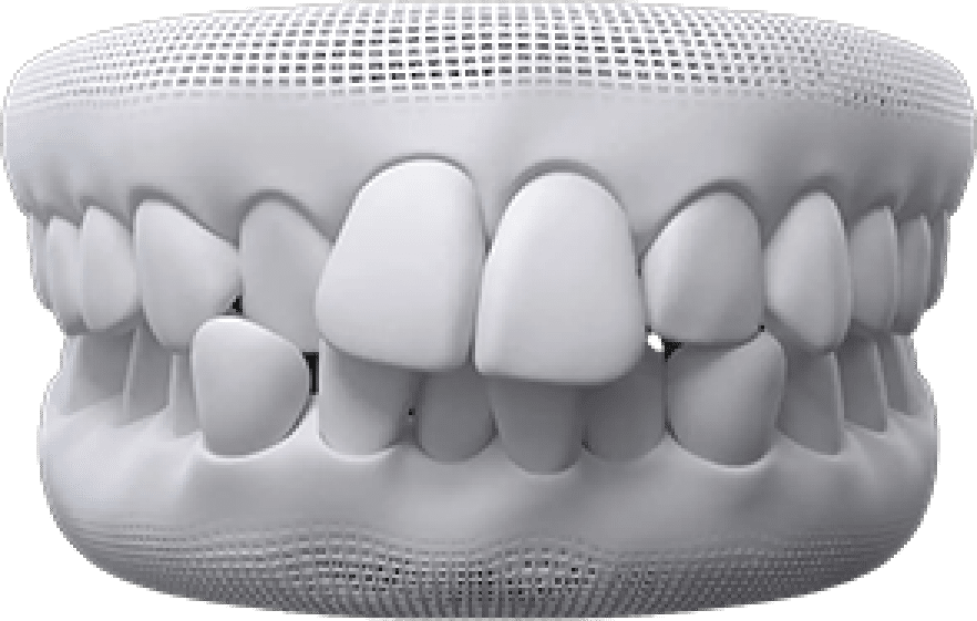 teeth-thumb01