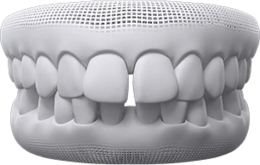 teeth-thumb02