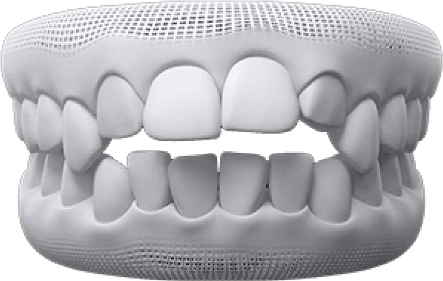 teeth-thumb03