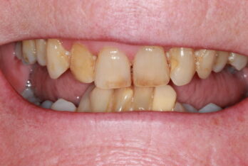 Before - 2 Green Dental Boutique