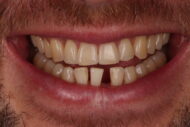 Before - 2 Green Dental Boutique
