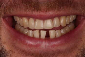 Before - 2 Green Dental Boutique