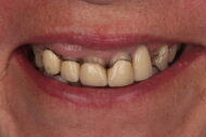 Before - 2 Green Dental Boutique
