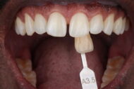 After - 2 Green Dental Boutique