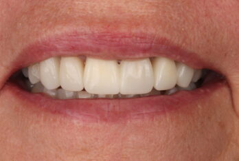 After - 2 Green Dental Boutique