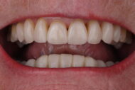 After - 2 Green Dental Boutique