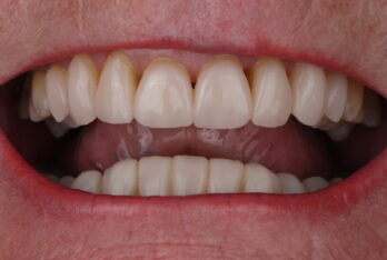 After - 2 Green Dental Boutique