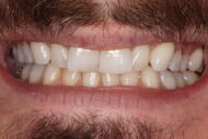 Before - 2 Green Dental Boutique