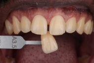 Before - 2 Green Dental Boutique