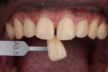 Before - 2 Green Dental Boutique