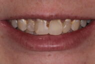 Before - 2 Green Dental Boutique