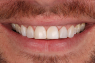 After - 2 Green Dental Boutique