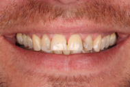 Before - 2 Green Dental Boutique