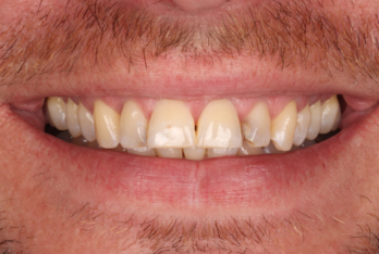 Before - 2 Green Dental Boutique
