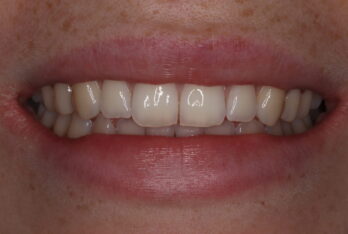 Before - 2 Green Dental Boutique