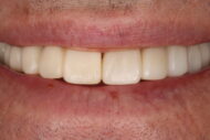 After - 2 Green Dental Boutique
