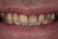 Before - 2 Green Dental Boutique