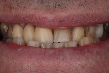 Before - 2 Green Dental Boutique