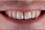 Before - 2 Green Dental Boutique