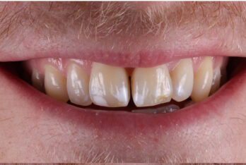Before - 2 Green Dental Boutique
