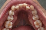 After - 2 Green Dental Boutique