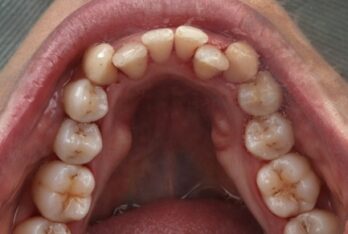 After - 2 Green Dental Boutique